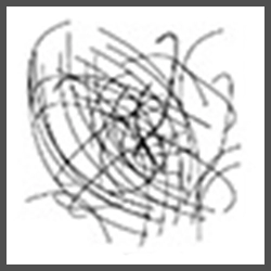 msrb1